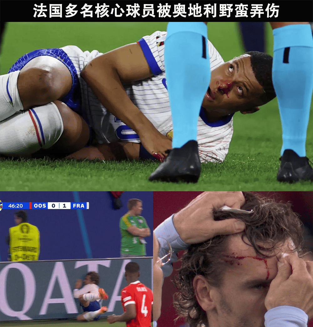 包含波兰队力克奥地利队，梁靖崑关键制胜的词条